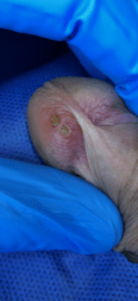 herpes genital